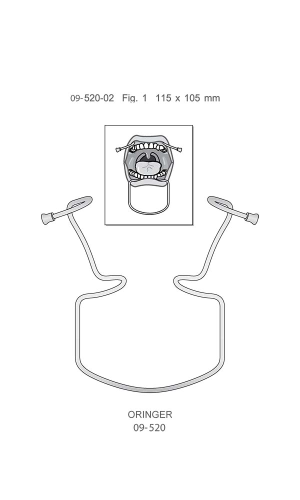 Mouth gags , ORINGER , Fig. 1 , Lower jaws