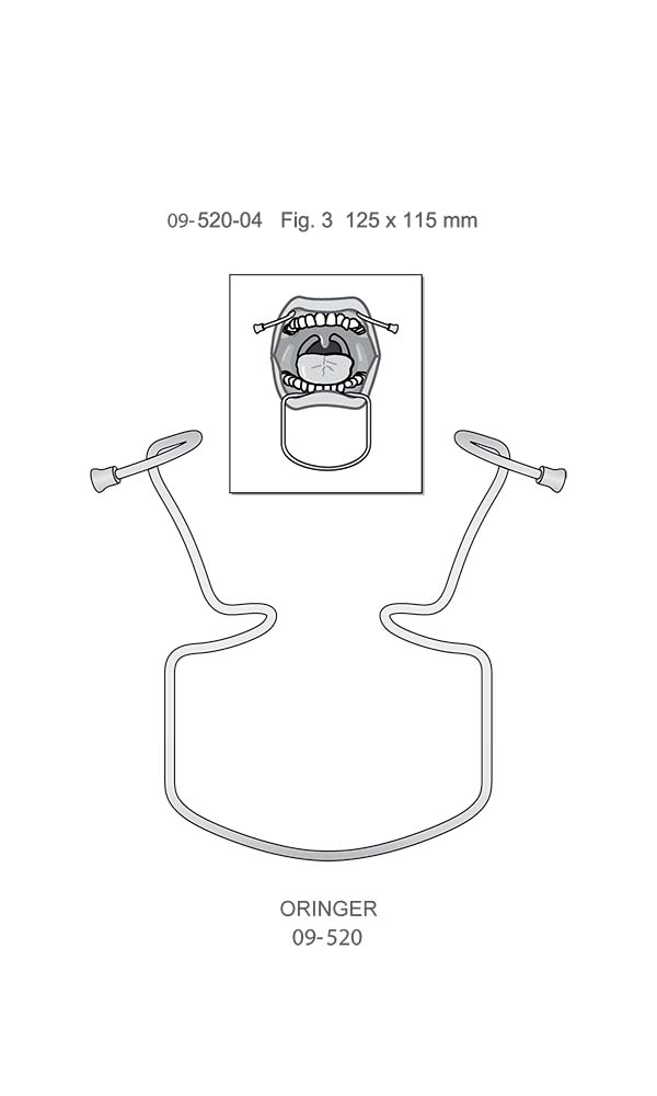 Mouth gags , ORINGER , Fig. 3 , Lower jaws