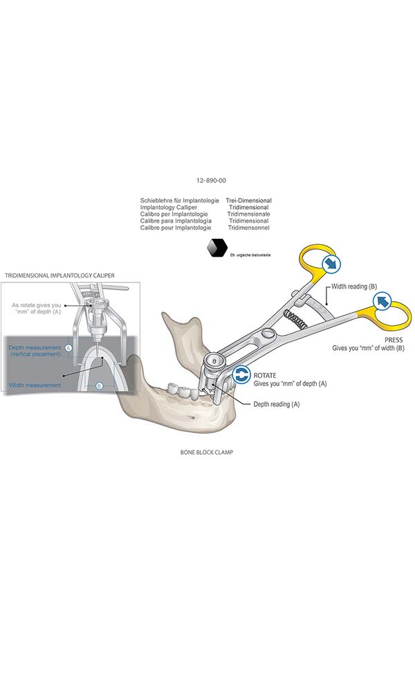 Osteometer , Implantology Calliper