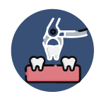 Dental Forceps